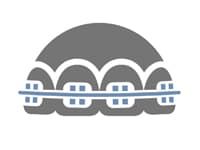 Вирівнювання зубів Харків