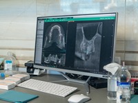  All about dental implants